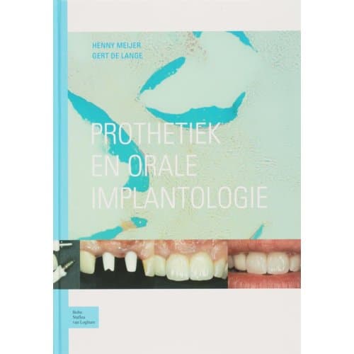 Prothetiek En Orale Implantologie - H. Meijer